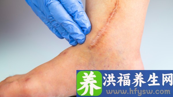 黄体功能不足会引起不排卵吗