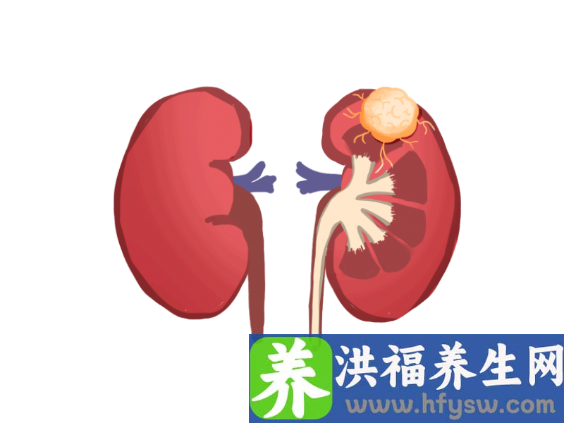 糖尿病护肾秘诀：规范治疗和勤筛查
