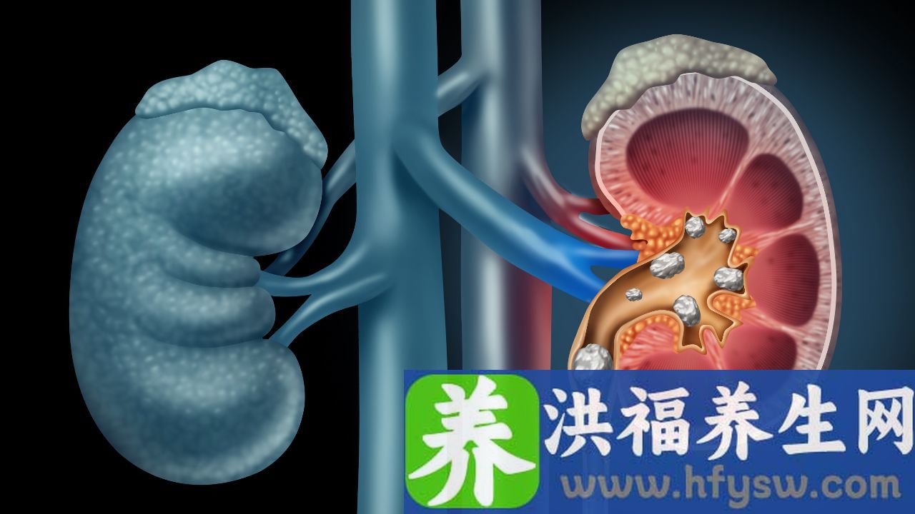 慢性肾病3期能治好吗