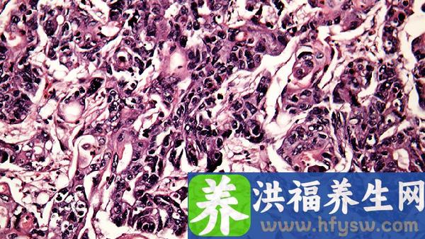 嗜酸性粒细胞增高的临床意义