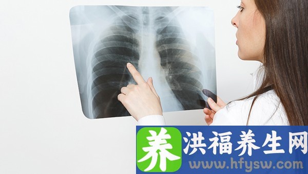 4周检查能排除梅毒跟生殖器疱疹感染吗