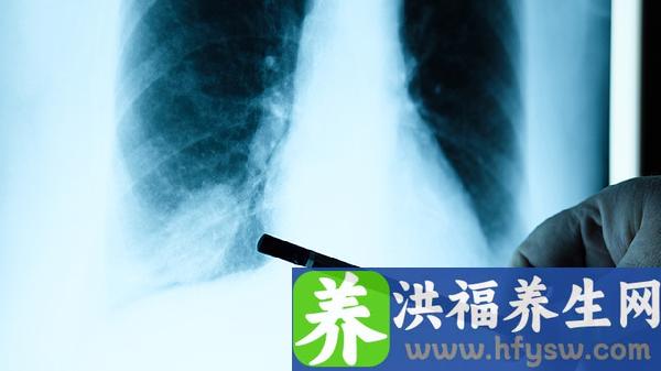 肿瘤标志物指标正常是否意味着不会有癌症