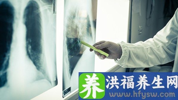 女性不孕要检查的项目有哪些？女性不孕要进行卵巢垂体功能检查吗？