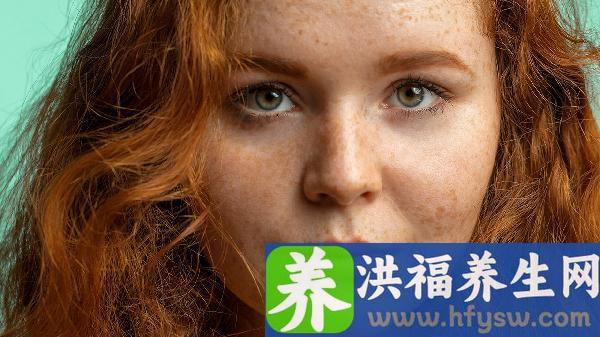女性红斑狼疮能治好吗能活多久