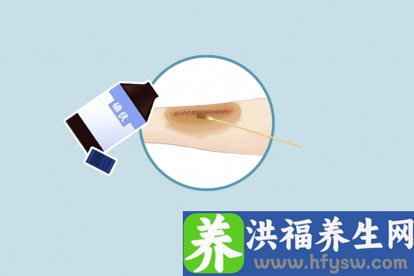 碘伏的10大禁忌