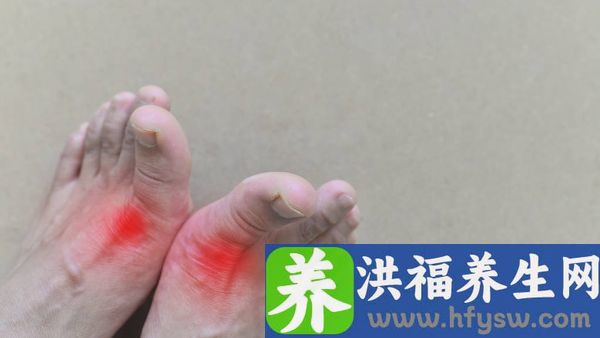 跌打损伤红肿用什么药最好