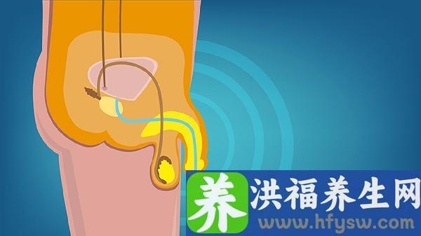 男人阳痿吃什么药效果比较好