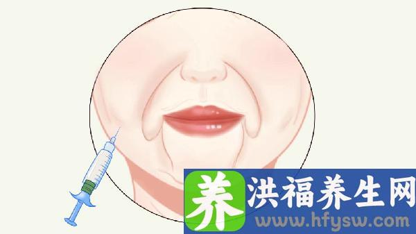 眼部除皱手术的价格是多少钱