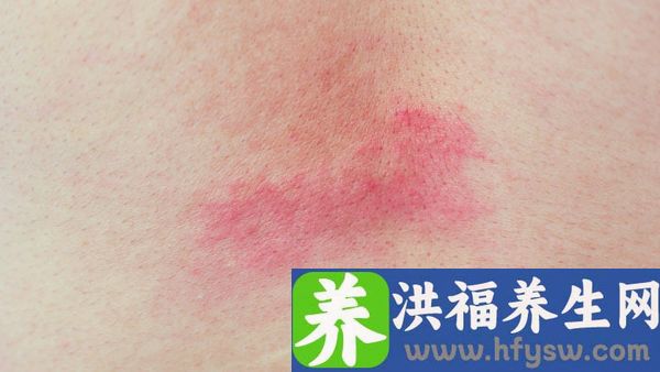 湿气重的人能吃藕粉吗