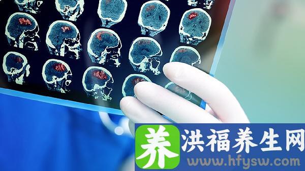 脑出血和蛛网膜下腔出血的主要区别