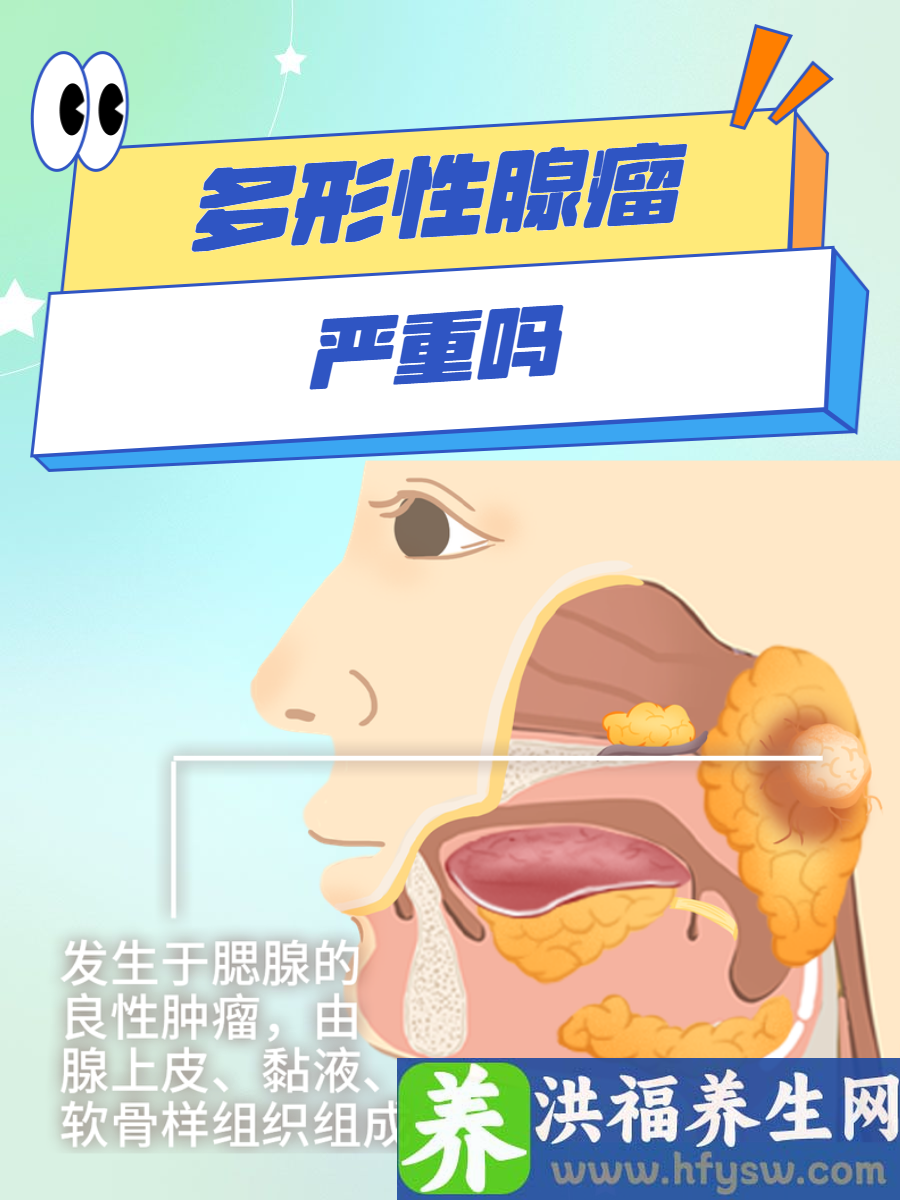 多形性腺瘤严重吗？正确认识多形性腺瘤