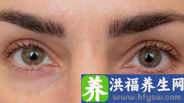 做激光去黑眼圈有哪些禁忌人群