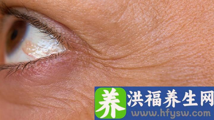 眼部皱纹很明显 5种方法能除皱