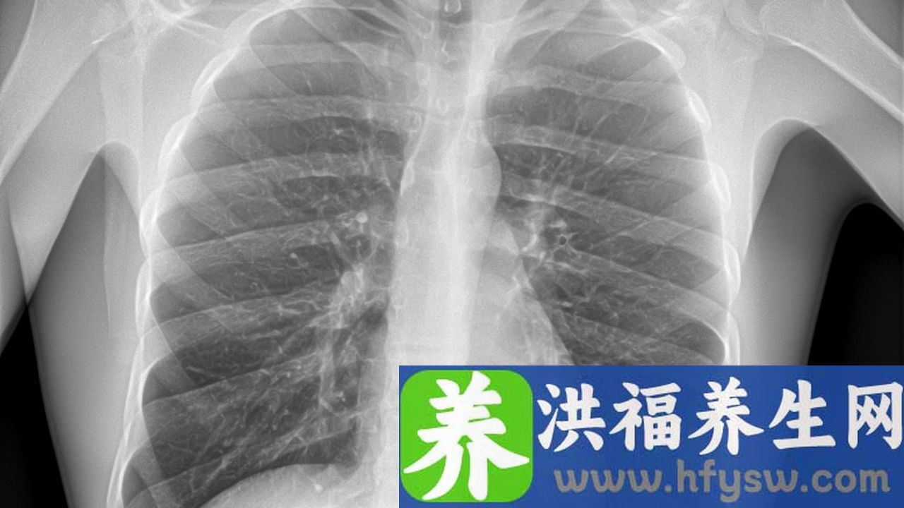 白肺是什么意思
