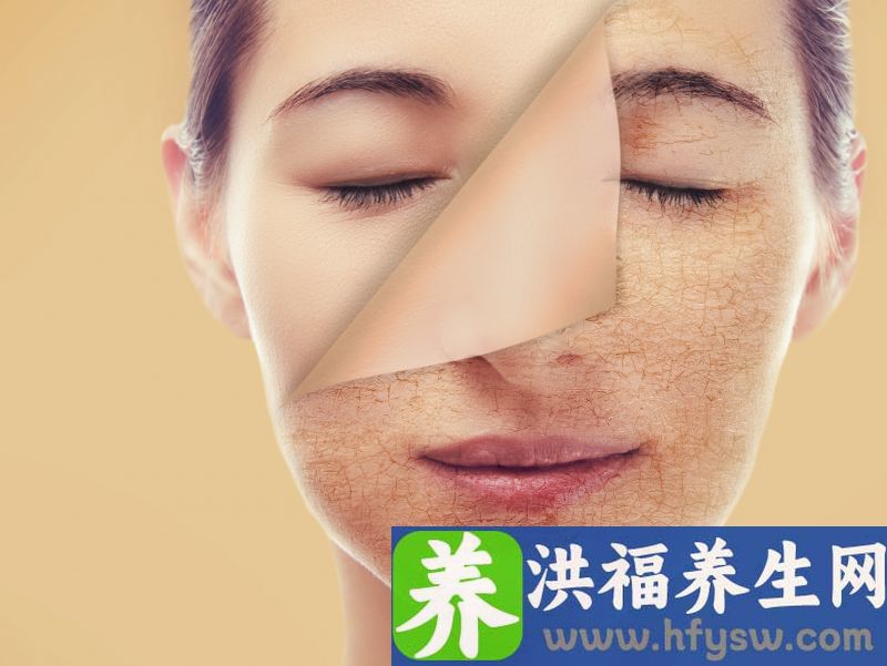 什么是光子嫩肤 光子嫩肤有哪些作用？