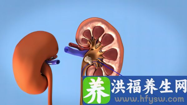 肾结石能吃豆腐吗