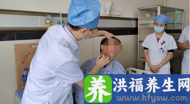 “面具男孩”高考后，在南方医院顺利进行免费瘢痕治疗