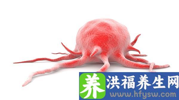 女性肿瘤标志物6项是哪些