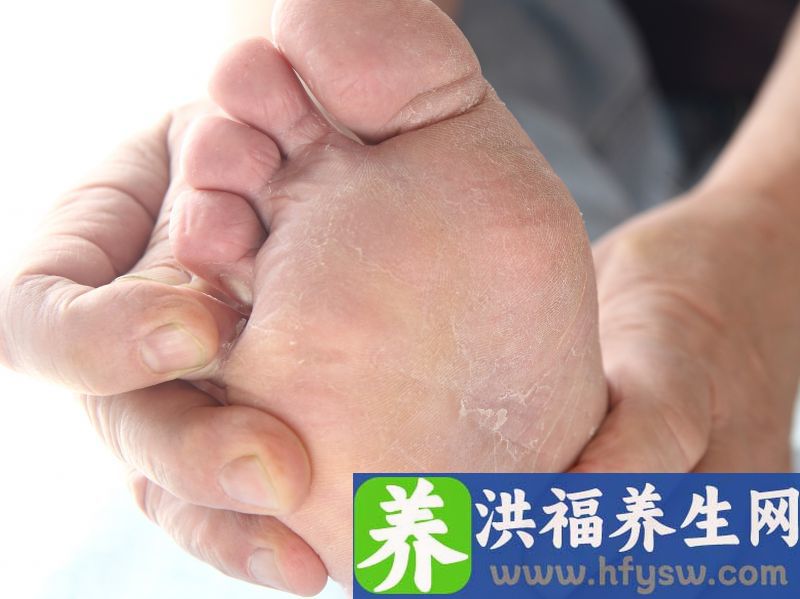 脚气病的病因