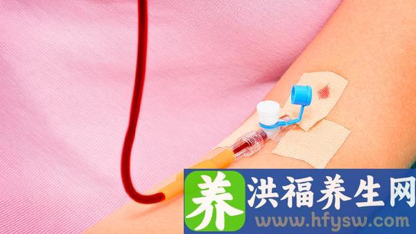 库欣综合征三大表现三高一低是什么