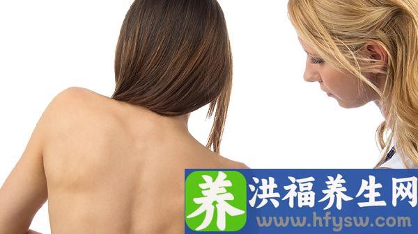 红斑狼疮跟性关系有关系吗