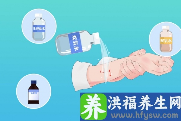 碘伏的10大禁忌