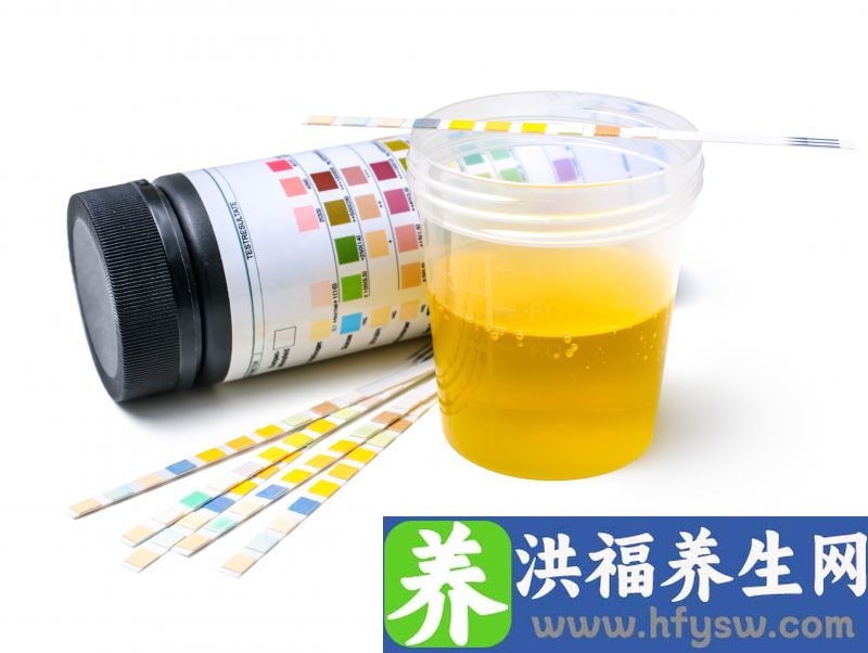总是排尿很黄，还有一股异味？身体在暗示你这3件事，要重视了