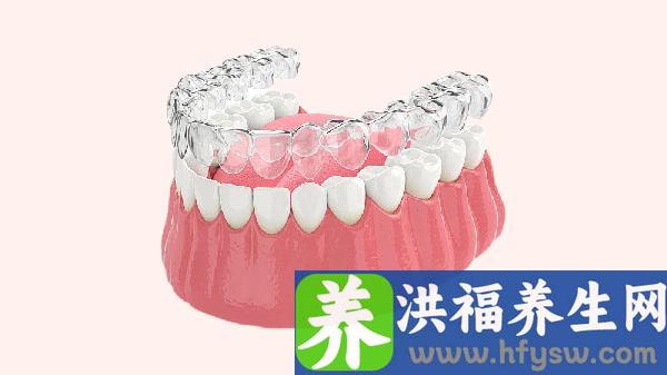 隐形矫正牙齿大概要多少钱