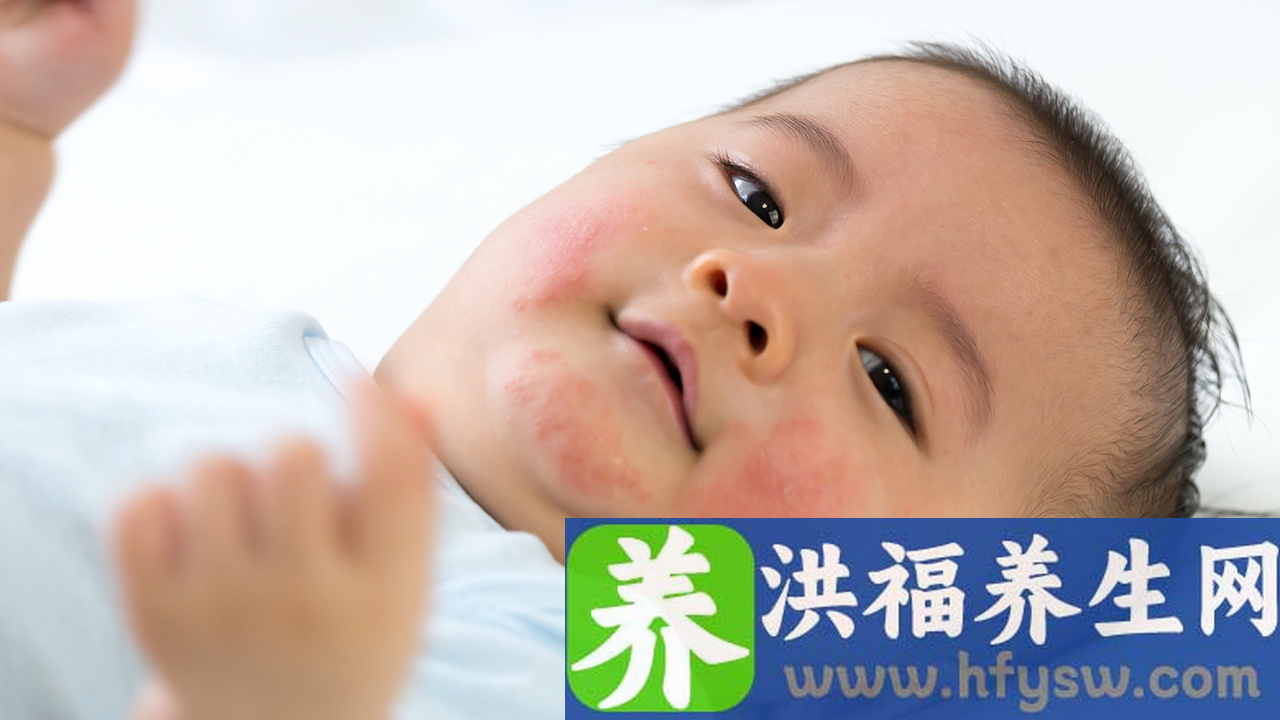 孩子拉白色大便可能是念珠菌感染 孩子拉白色大便如何应对