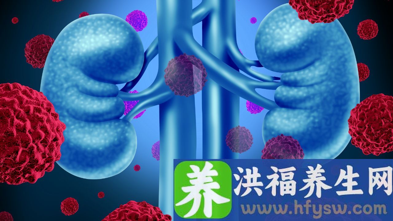 女性为什么会尿酸高