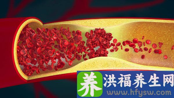 女性血沉36严重吗