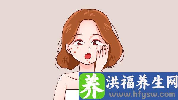 做冷冻治疗去痘疤有哪些禁忌人群