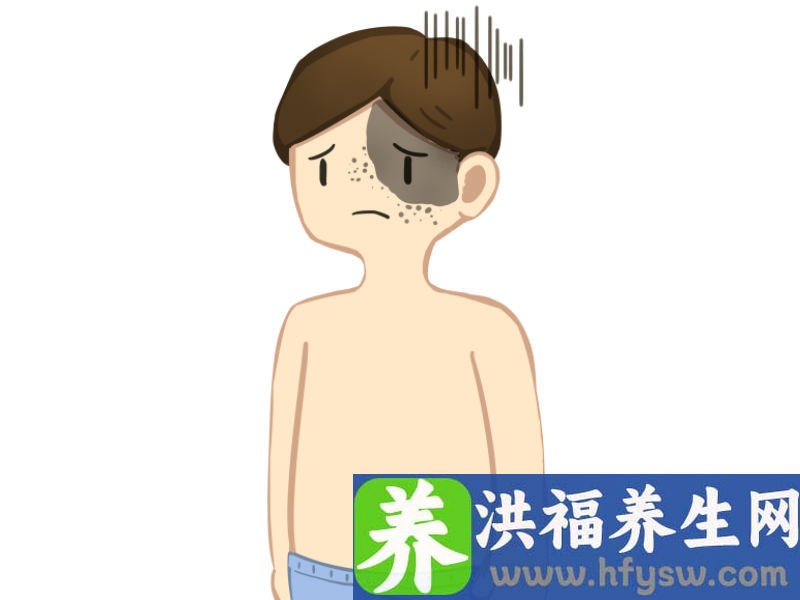 南方医院增城分院整形美容外科实施局部皮瓣转移“祛痣”手术