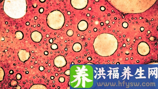 细菌前列腺炎睾丸疼