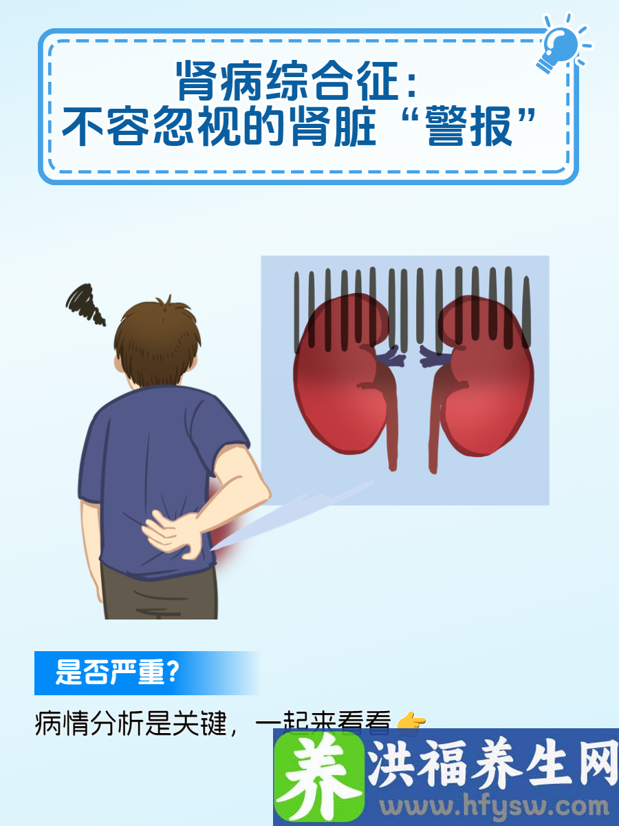 肾病综合征：不容忽视的肾脏“警报”