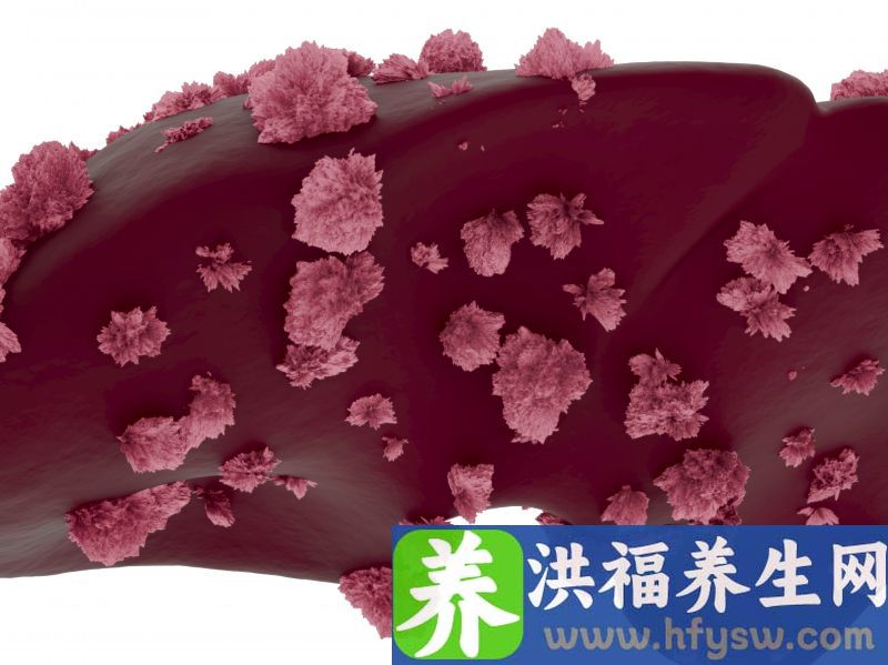 越来越多人得癌？背后隐藏着4个原因！多一个人知道，少一个悲剧