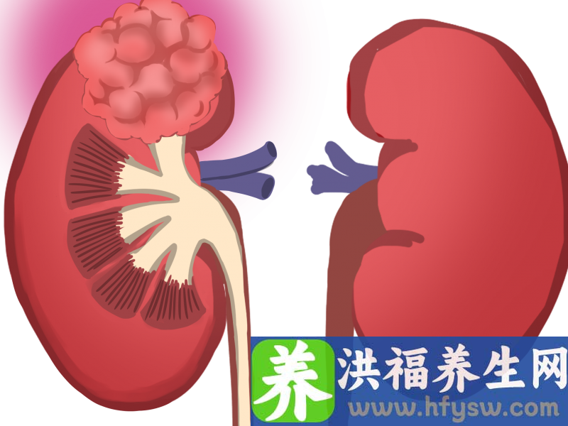 毫米级微创手术的精准实施，让87岁胃肿瘤出血休克的老人重获新生