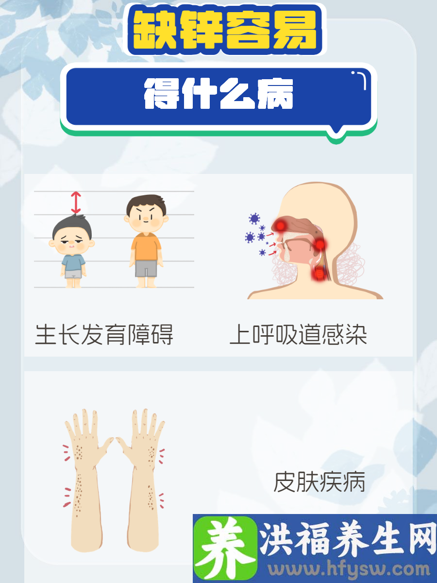 缺锌容易得什么病？一篇文章带你了解