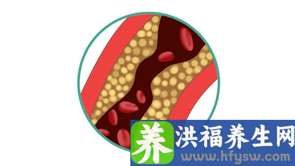 血脂降下来后身体感受有哪些