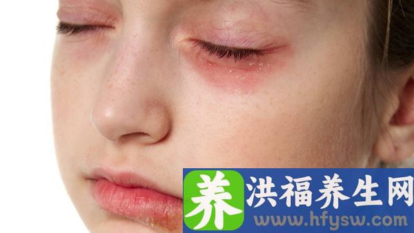 嘴歪眼斜瞬间失去意识怎么回事