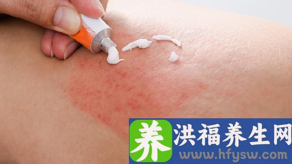 生殖器疱疹治疗不当会怎样