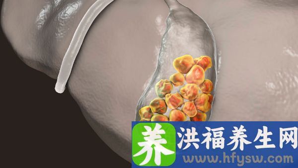 肝结节会引起疼痛吗