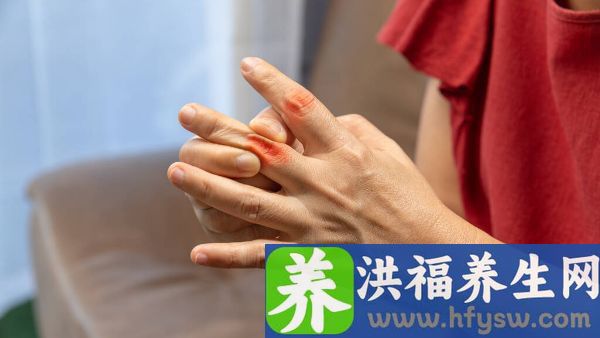 一个手指关节肿胀是什么原因
