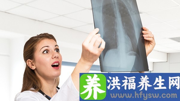 氢溴酸右美沙芬口服溶液可以治疗新冠肺炎吗 新型冠状病毒轻度吃什么药治疗