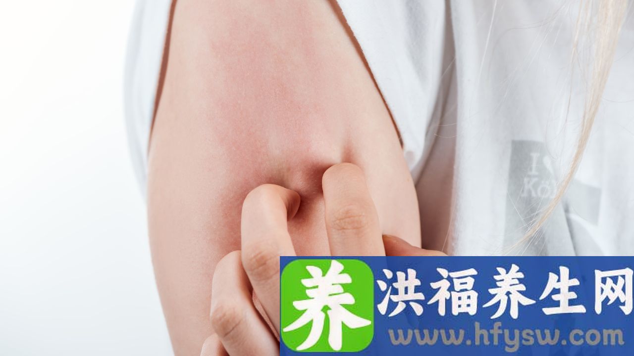 干燥综合征有哪些表现