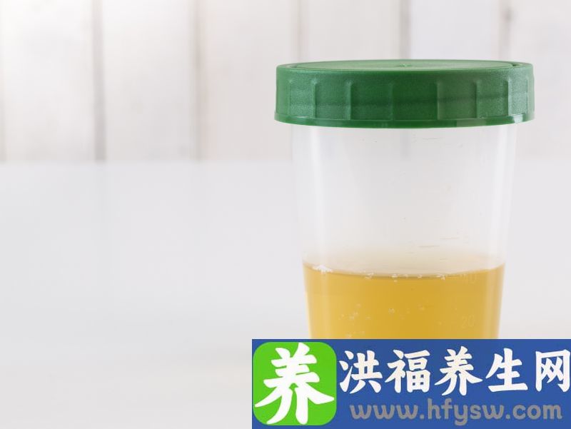 早上起床第一泡尿，如果有3个特征，恭喜你还很健康