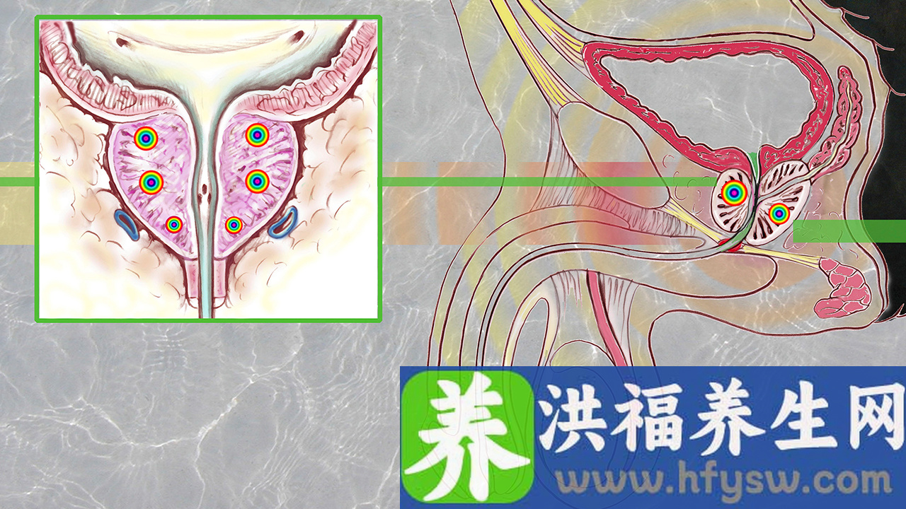 未婚男性阳痿怎么恢复？这些小技巧不摆脱男性阳痿