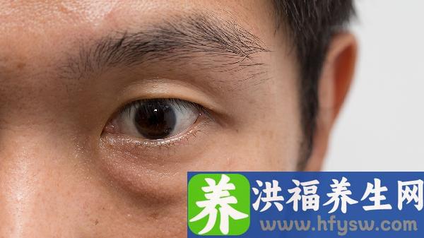 除眼袋手术后要注意哪些事项