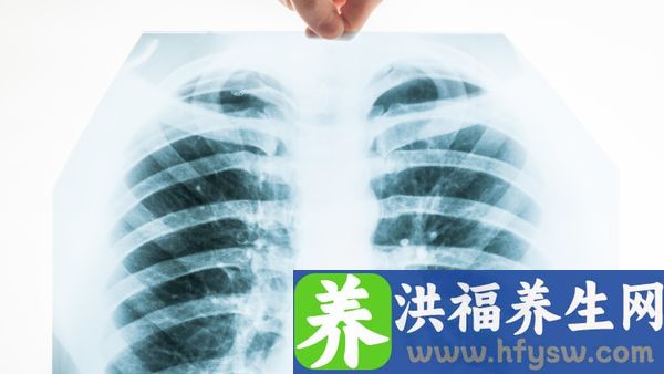 肺不张有哪些症状
