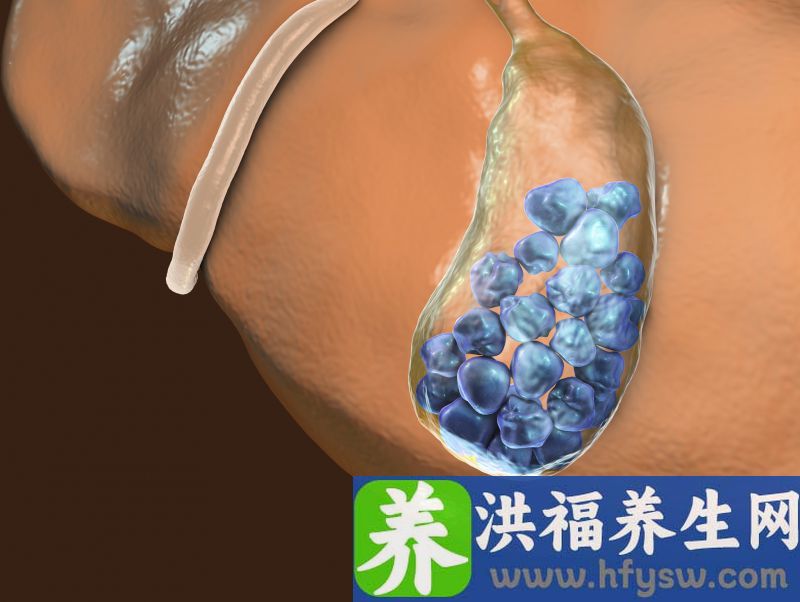 肾结石如何止痛